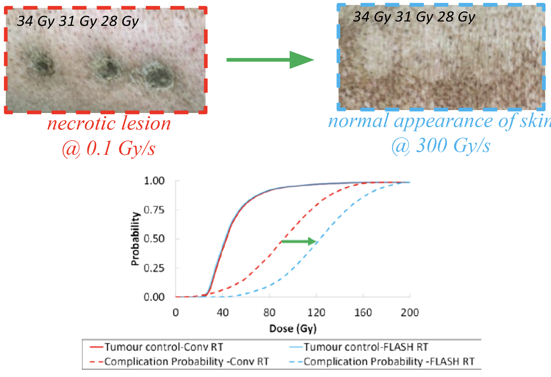 A comparison of skin conditions: on the left, a necrotic lesion labeled with dosage information at 0.1 Gy/s, and on the right, normal skin appearance at 300 Gy/s. Below, a graph illustrates tumor control and complication probabilities against radiation dosages.